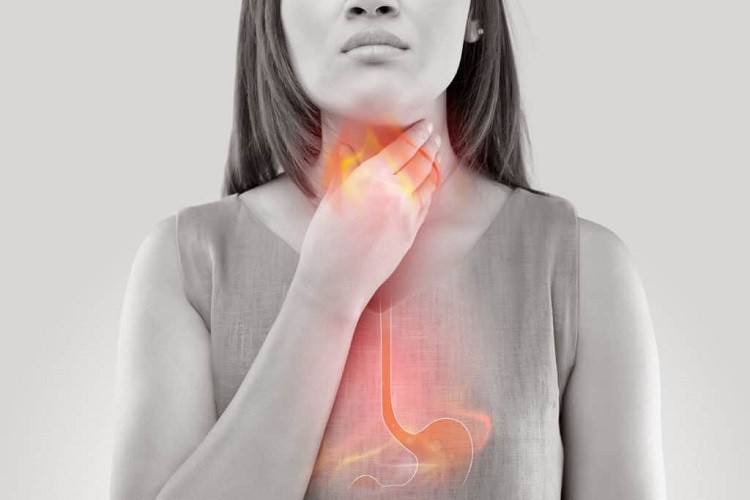 Tất tần tật về bệnh trào ngược dạ dày mà bạn cần biết