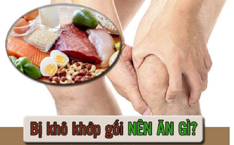 Khô khớp ăn gì và kiêng gì giúp tăng dịch khớp, tái tạo sụn