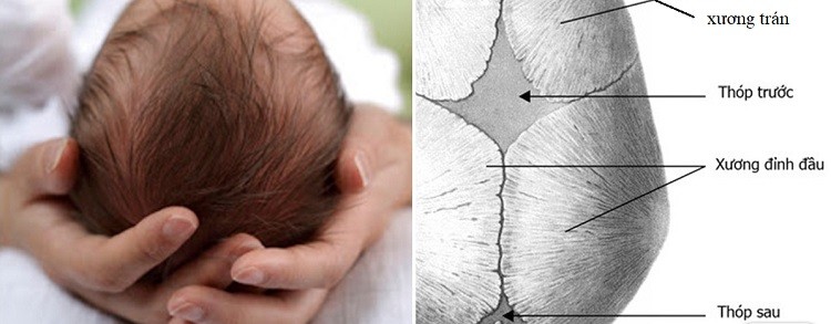 Thóp liền quá muộn