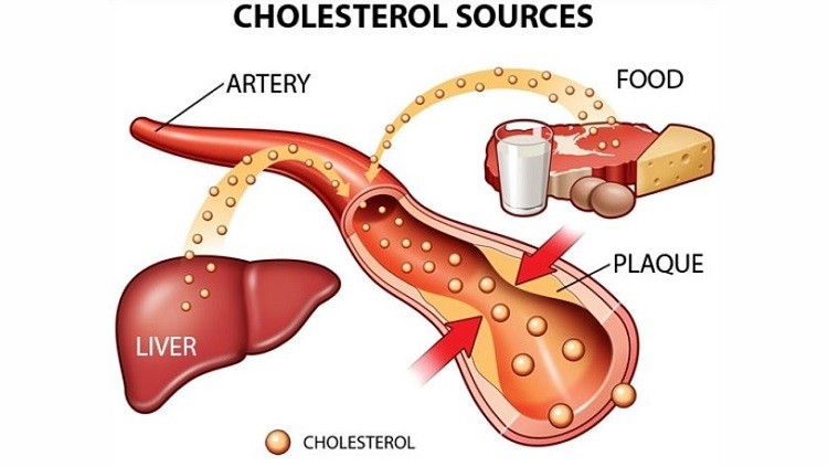 Giảm cholesterol