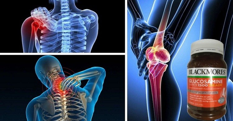 glucosamine blackmores review, review blackmores glucosamine, glucosamine blackmores của úc có tốt không, giá glucosamine 1500mg của úc, glucosamine 1500mg của úc, blackmore glucosamine review, glucosamine của úc loại nào tốt, blackmores glucosamine review, glucosamine blackmores của úc, glucosamine 1500mg úc, blackmores glucosamine sulfate 1500mg one-a-day