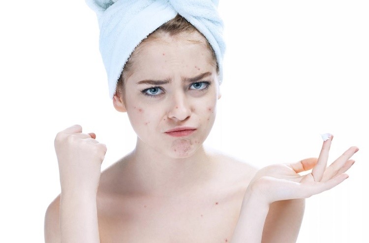 Sử dụng thêm các loại kem điều trị dị ứng là biện pháp tối ưu nhất