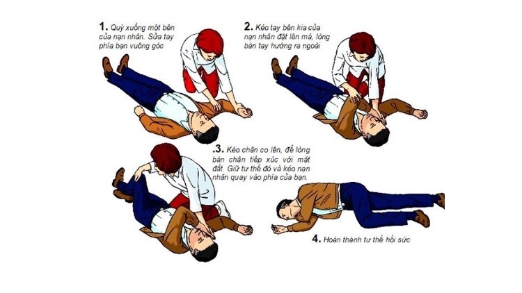 sơ cứu đột quỵ