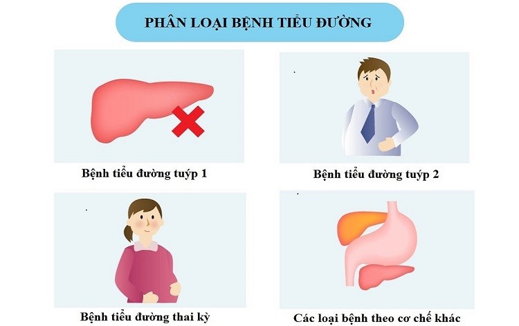 Các loại tiểu đường