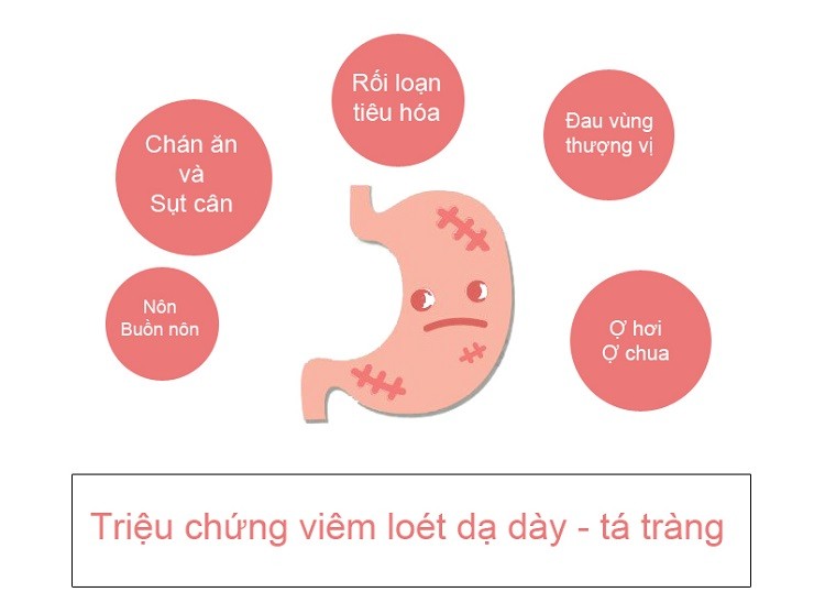 Triệu chứng viêm loét dạ dày