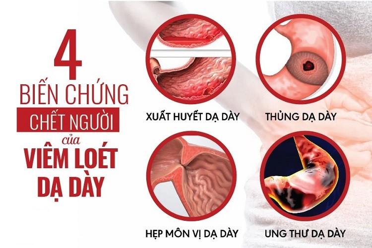 Biến chứng viêm loét dạ dày