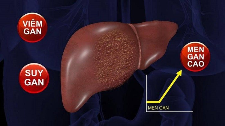 viêm gan, suy gan hay ung thư gan