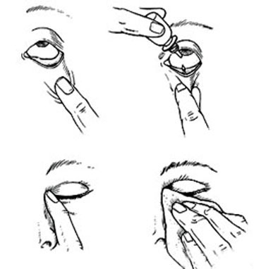 thuốc nhỏ mắt tốt cho người cận thị, thuốc nhỏ mắt giảm cận thị, thuốc nhỏ mắt trị cận thị của nhật, mắt cận nên dùng thuốc nhỏ mắt nào, thuốc nhỏ mắt nào tốt cho mắt cận, bị cận thị nên dùng thuốc nhỏ mắt nào, cận thị có nên dùng thuốc nhỏ mắt rohto, thuốc nhỏ mắt nào tốt cho người cận thị, thuốc nhỏ mắt cho mắt cận thị, cận thị có nên dùng thuốc nhỏ mắt, người bị cận nên dùng thuốc nhỏ mắt nào, thuốc nhỏ mắt dùng cho người cận thị