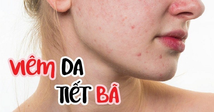 Bệnh ngoài da hiếm gặp