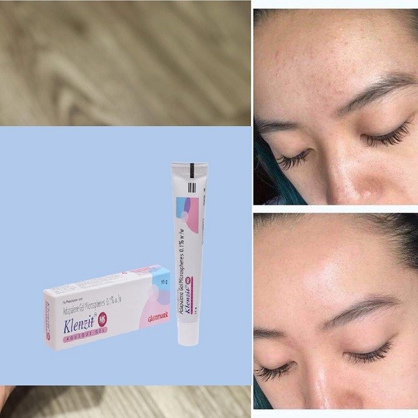 klenzit ms kết hợp với gì