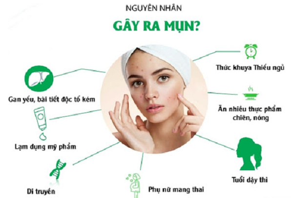 các bước skincare cho da mụn ban đêm, các bước skincare cho da dầu mụn ban đêm, các bước skincare cơ bản cho da dầu mụn, các bước skincare cho da mụn tuổi dậy thì, các bước skincare tối cho da mụn, các bước skincare cho da mụn ban ngày, các bước skincare cơ bản cho da mụn